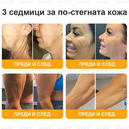 🇧🇬 Специална оферта за България ✨ Крем с пчелна отрова 🔥 САМО ДНЕС: 80% ОТСТЪПКА! 💎💎