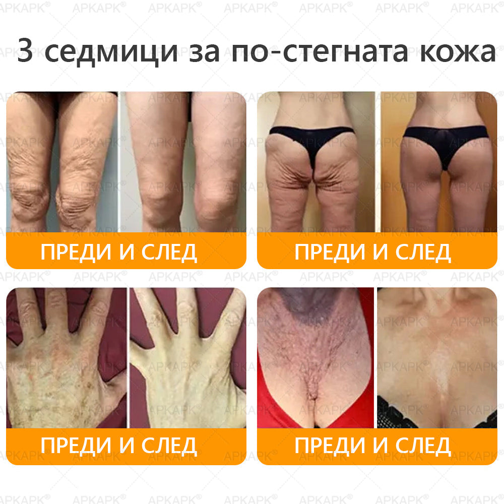 🇧🇬 Специална оферта за България ✨ Крем с пчелна отрова 🔥 САМО ДНЕС: 80% ОТСТЪПКА! 💎💎