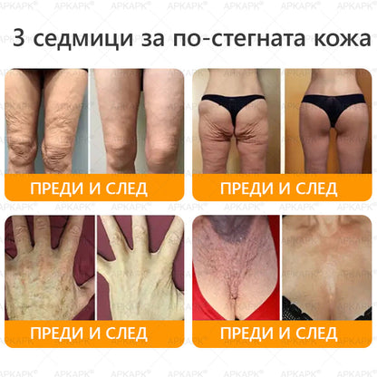 🇧🇬 Специална оферта за България ✨ Крем с пчелна отрова 🔥 САМО ДНЕС: 80% ОТСТЪПКА! 💎💎